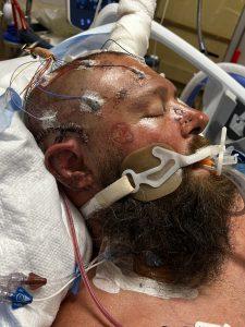 Matthew in SICU