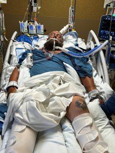 Matthew Hector in SICU