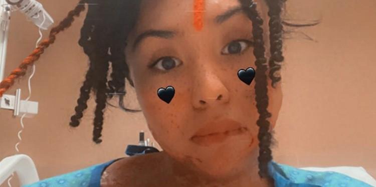 pam garcia cruz, burn patient, burn center, trauma care for burns, healing center for burn victims